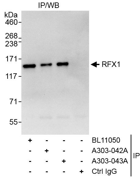 RFX1 Antibody in Immunoprecipitation (IP)