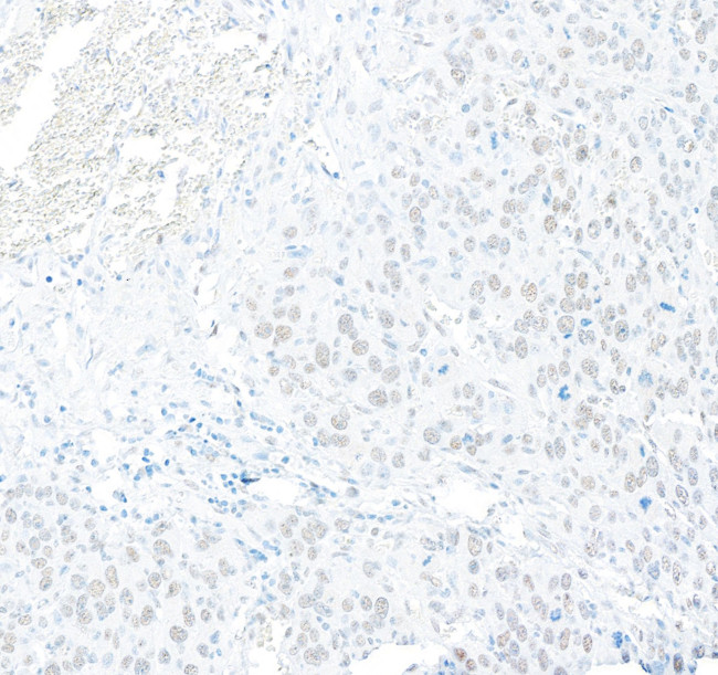 RFX1 Antibody in Immunohistochemistry (Paraffin) (IHC (P))