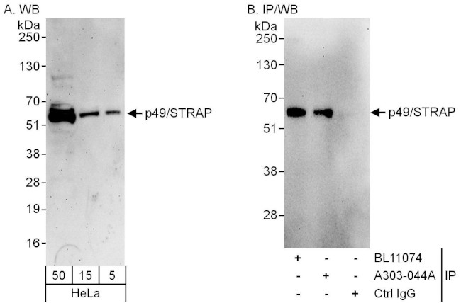 p49/STRAP Antibody in Western Blot (WB)
