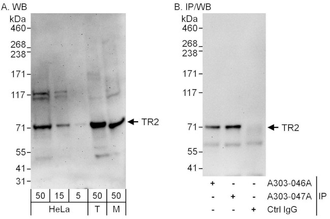 TR2 Antibody in Western Blot (WB)