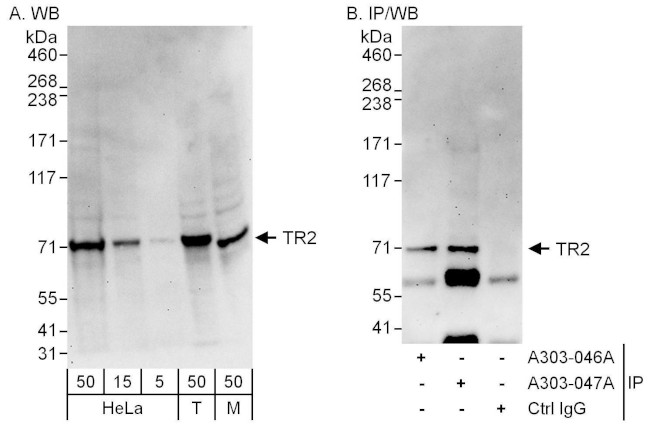 TR2 Antibody in Western Blot (WB)