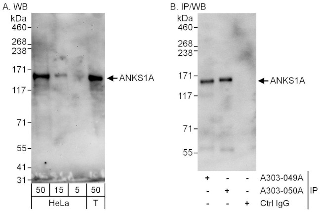 ANKS1A Antibody in Western Blot (WB)