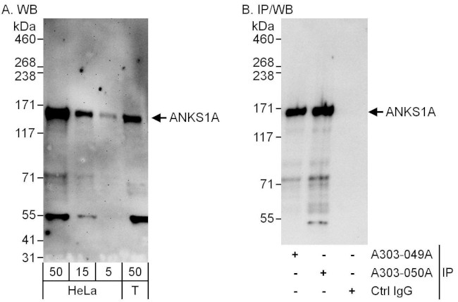 ANKS1A Antibody in Western Blot (WB)