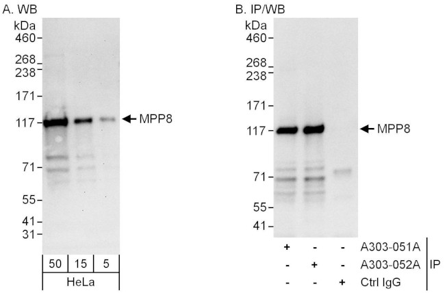 MPP8 Antibody in Western Blot (WB)