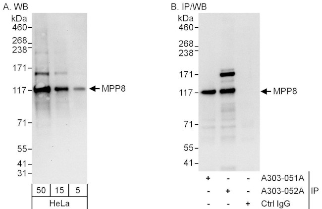 MPP8 Antibody in Western Blot (WB)