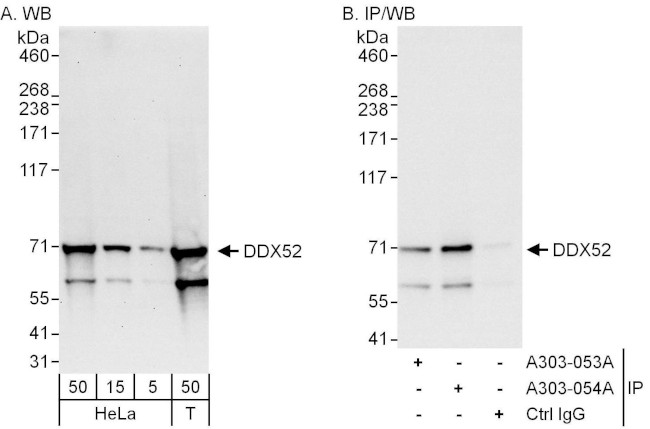 DDX52 Antibody in Western Blot (WB)