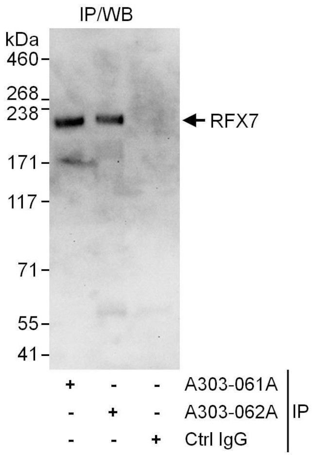 RFX7 Antibody in Immunoprecipitation (IP)