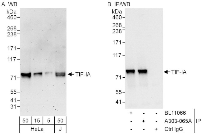 TIF-IA Antibody in Western Blot (WB)