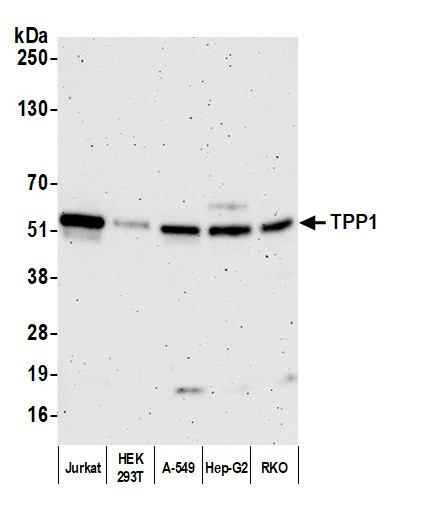 TPP1 Antibody in Western Blot (WB)