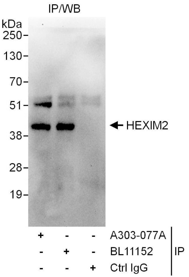 HEXIM2 Antibody in Immunoprecipitation (IP)
