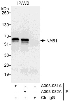 NAB1 Antibody in Immunoprecipitation (IP)