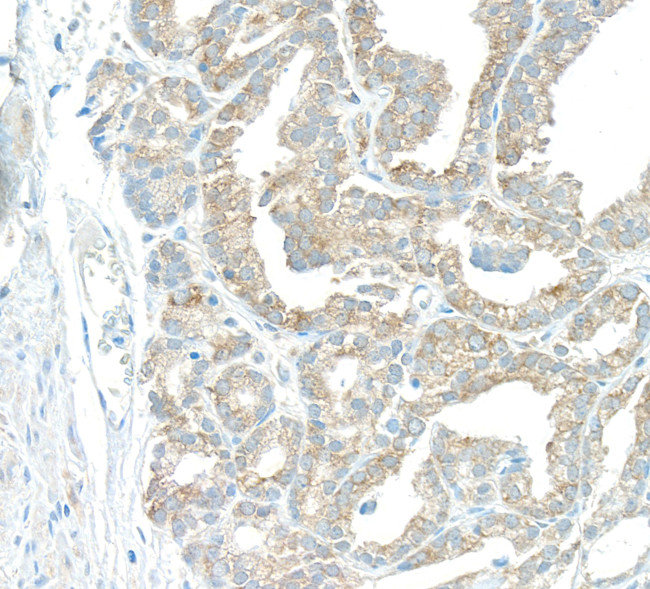 EBP1 Antibody in Immunohistochemistry (Paraffin) (IHC (P))