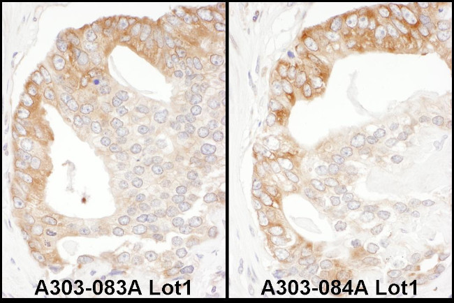 EBP1 Antibody in Immunohistochemistry (Paraffin) (IHC (P))