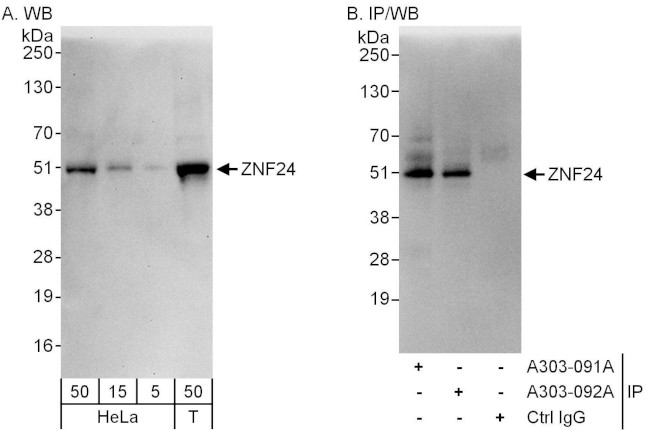 ZNF24 Antibody in Western Blot (WB)