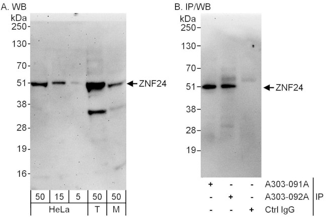ZNF24 Antibody in Western Blot (WB)