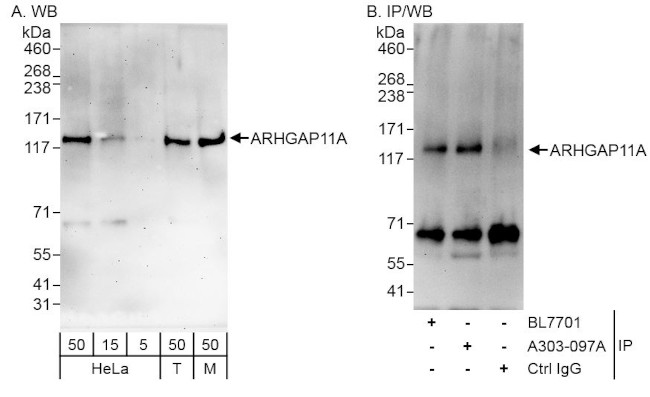 ARHGAP11A Antibody in Western Blot (WB)