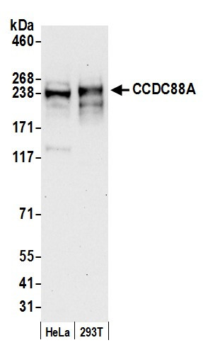 CCDC88A Antibody in Western Blot (WB)