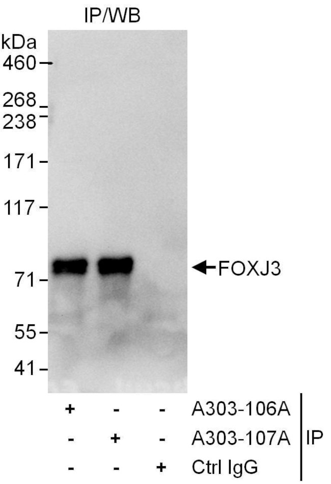 FOXJ3 Antibody in Immunoprecipitation (IP)