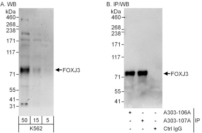 FOXJ3 Antibody in Western Blot (WB)