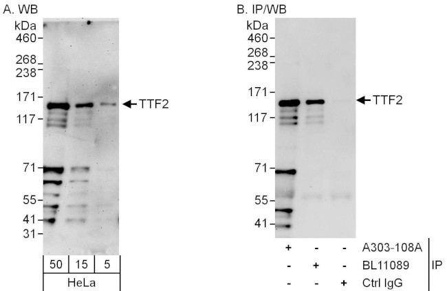 TTF2 Antibody in Western Blot (WB)