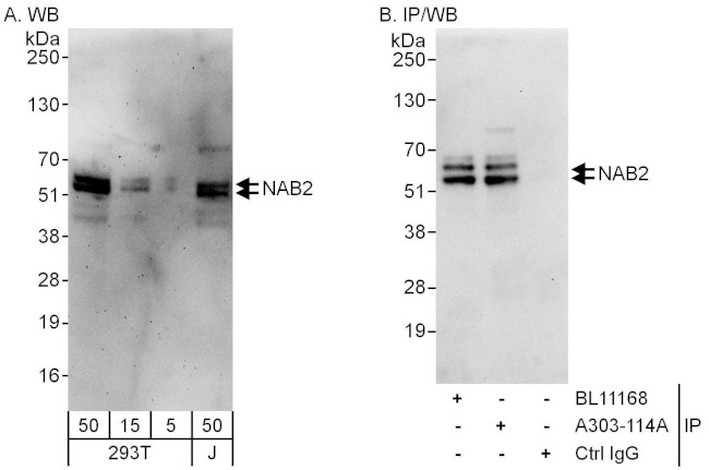 NAB2 Antibody in Western Blot (WB)