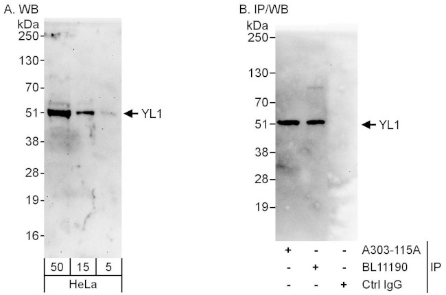 YL1 Antibody in Western Blot (WB)