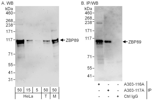 ZBP89 Antibody in Western Blot (WB)
