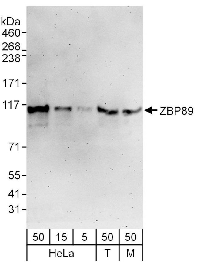 ZBP89 Antibody in Western Blot (WB)
