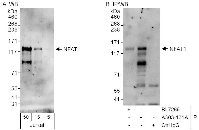 NFAT1 Antibody in Western Blot (WB)