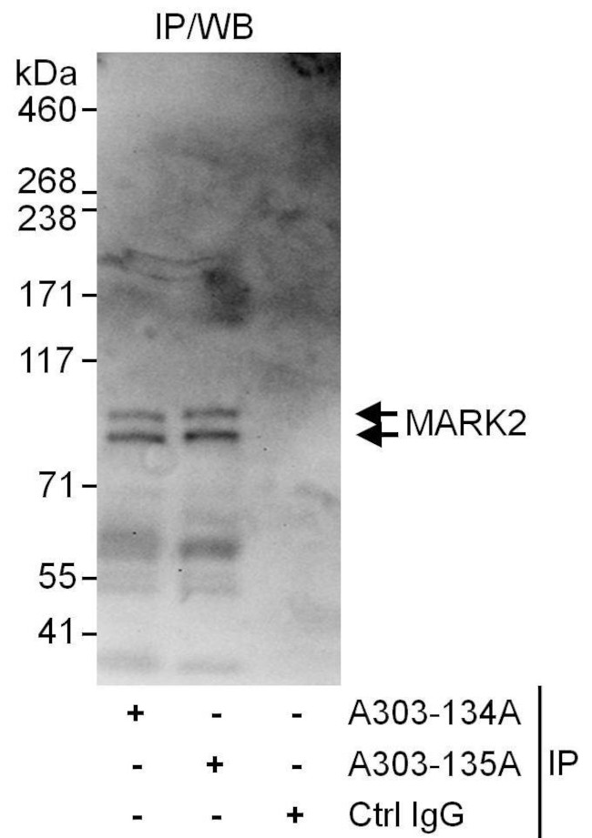 MARK2 Antibody in Immunoprecipitation (IP)