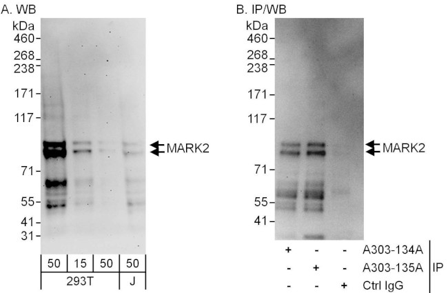 MARK2 Antibody in Western Blot (WB)