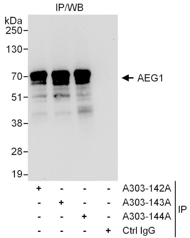 AEG1 Antibody in Immunoprecipitation (IP)