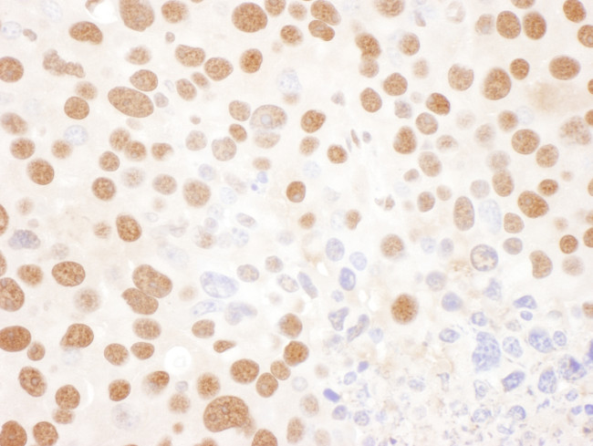 NF45 Antibody in Immunohistochemistry (Paraffin) (IHC (P))