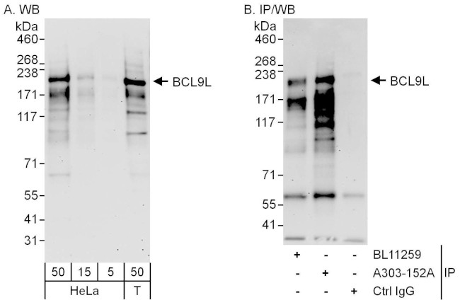 BCL9L Antibody in Western Blot (WB)