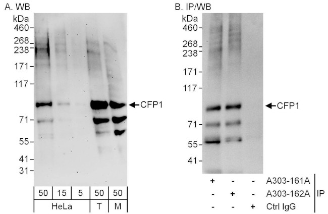 CFP1 Antibody in Western Blot (WB)