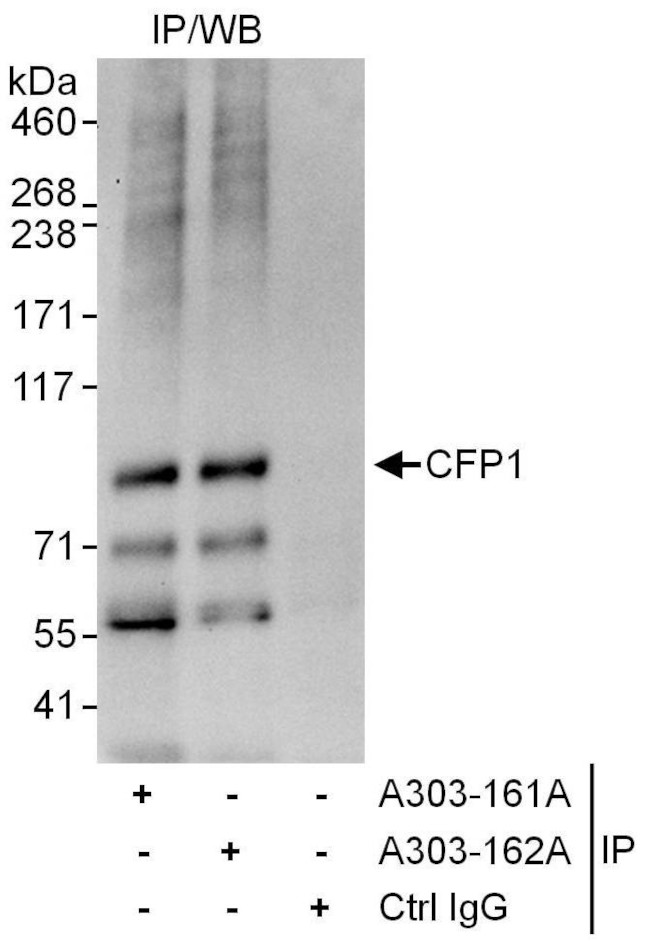 CFP1 Antibody in Immunoprecipitation (IP)
