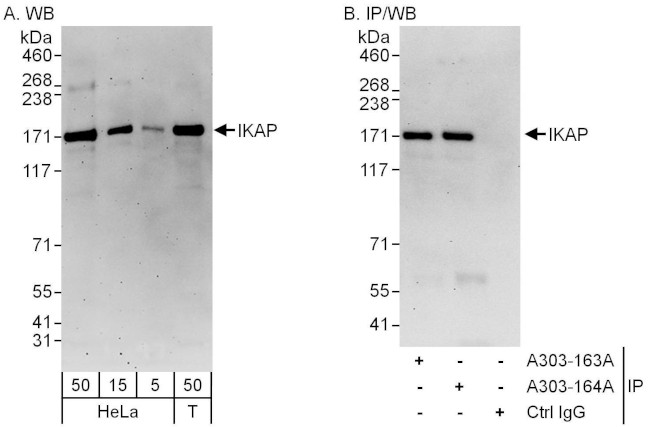 IKAP Antibody in Western Blot (WB)