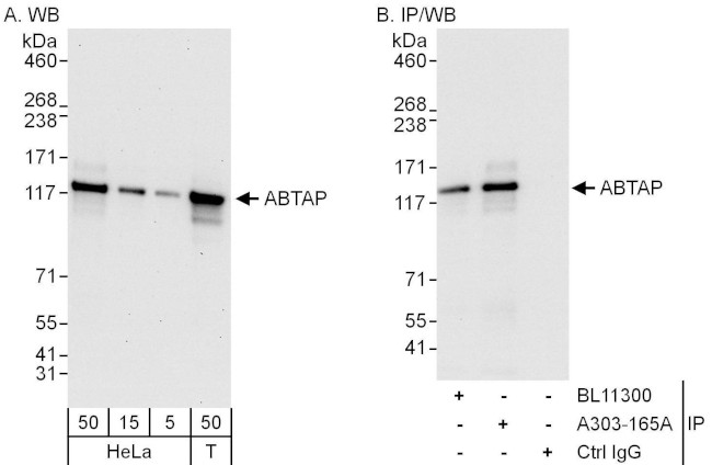 ABTAP Antibody in Western Blot (WB)