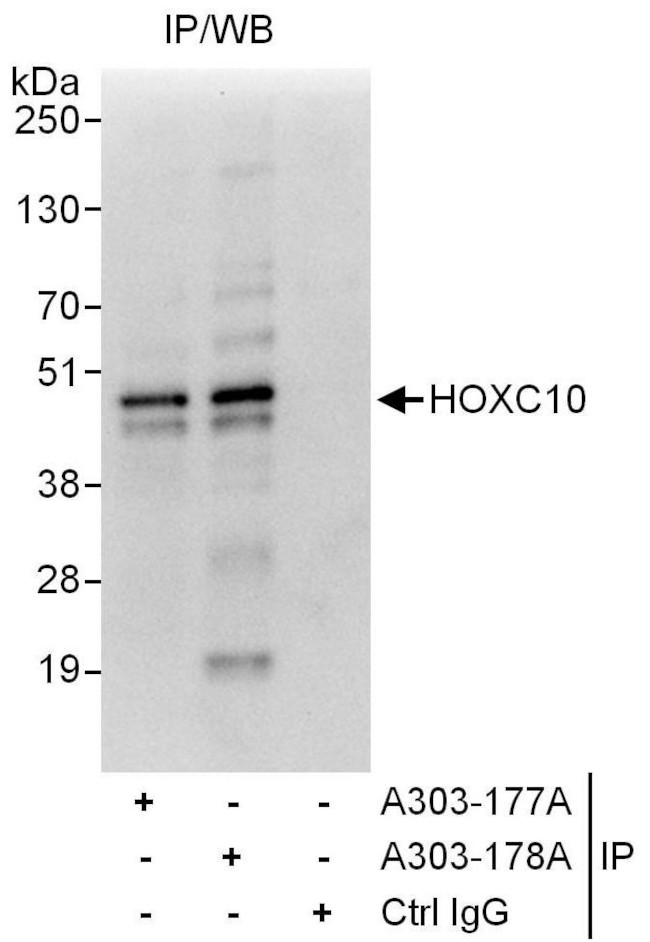 HOXC10 Antibody in Immunoprecipitation (IP)