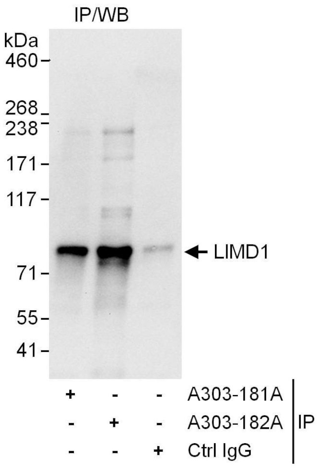 LIMD1 Antibody in Immunoprecipitation (IP)