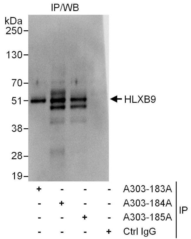 HLXB9 Antibody in Immunoprecipitation (IP)