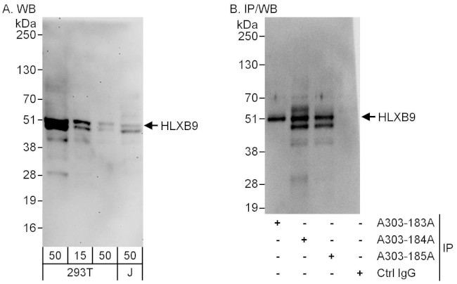 HLXB9 Antibody in Western Blot (WB)
