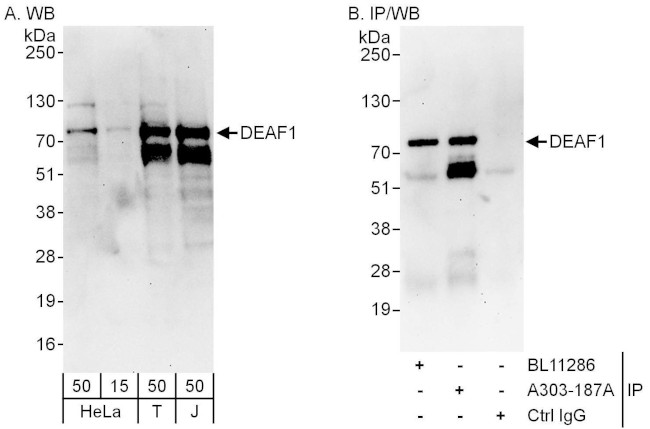 DEAF1 Antibody in Western Blot (WB)
