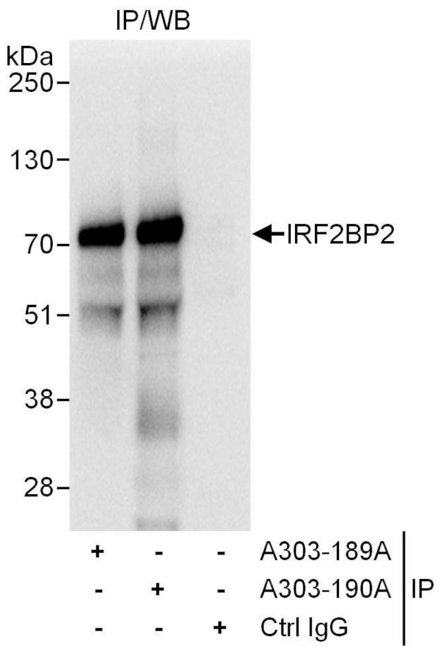 IRF2BP2 Antibody in Immunoprecipitation (IP)