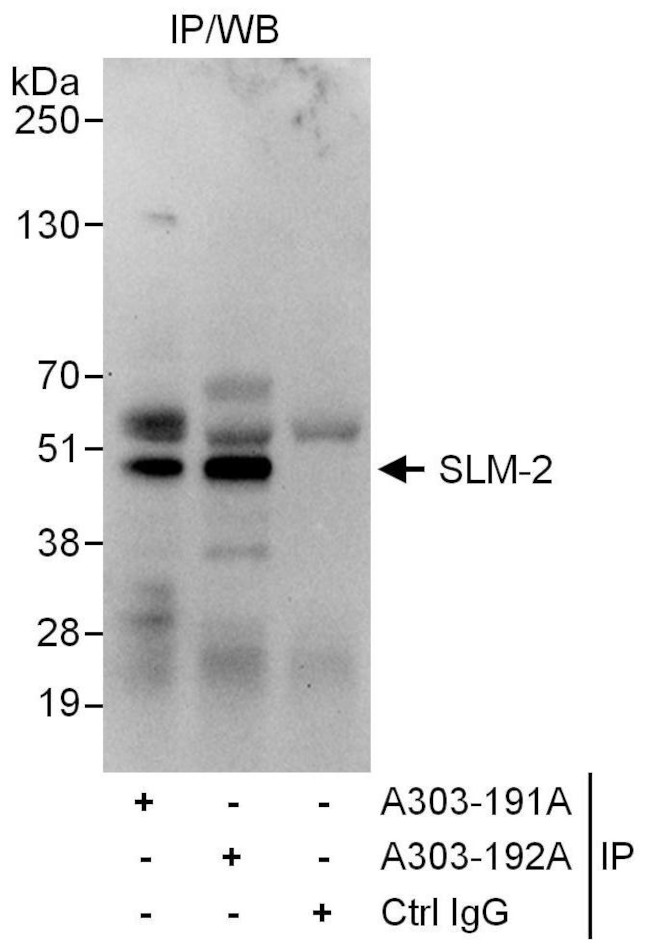 SLM-2 Antibody in Immunoprecipitation (IP)