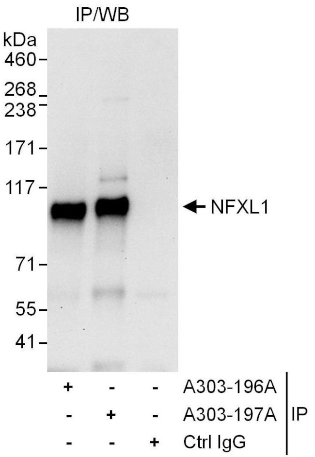NFXL1 Antibody in Immunoprecipitation (IP)