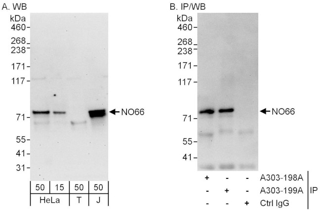 NO66 Antibody in Western Blot (WB)