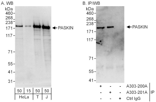 PASKIN Antibody in Western Blot (WB)