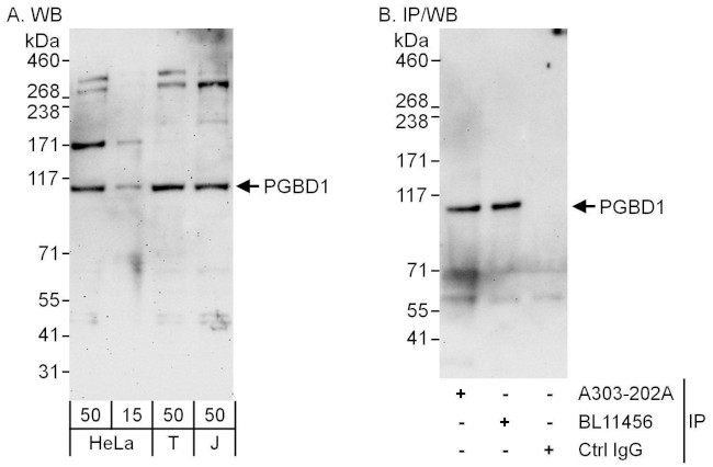 PGBD1 Antibody in Western Blot (WB)