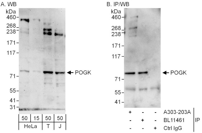POGK Antibody in Western Blot (WB)